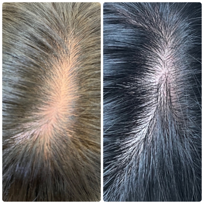 長年の悩みが解消されました!